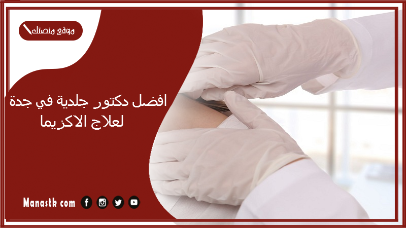 افضل دكتور جلدية في جدة لعلاج الاكزيما