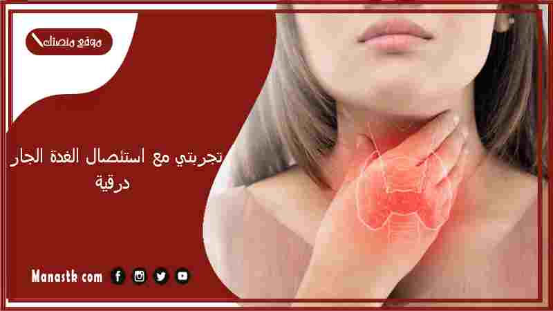 تجربتي مع استئصال الغدة الجار درقية.. علاج الغدة الجار درقية النشطة