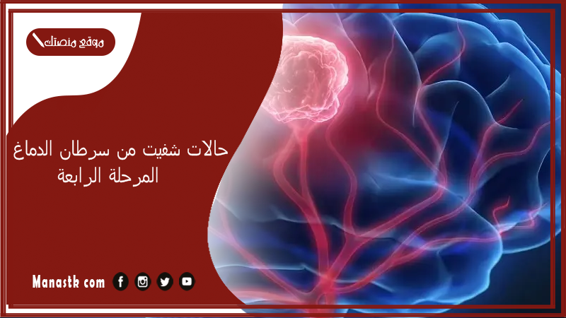 حالات شفيت من سرطان الدماغ المرحلة الرابعة