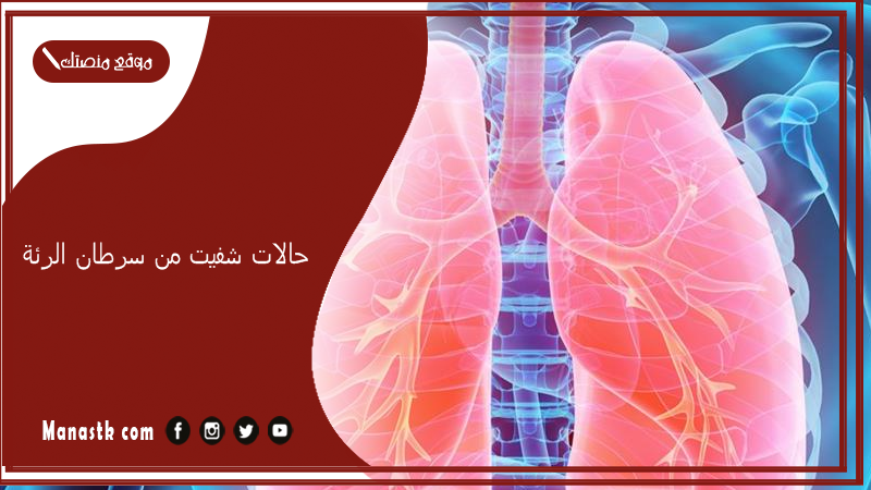 حالات شفيت من سرطان الرئة.. هل يوجد امل في علاج سرطان الرئة؟